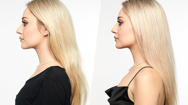 Quick And Easy Ways To Fix Brassy Hair At Home
